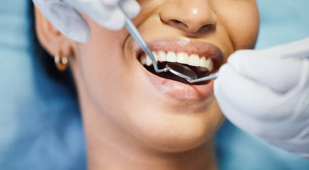 Best Emergency Wisdom Teeth Removal in New Hope, MN